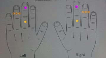 Certification Course in Acutherapy Healing Science